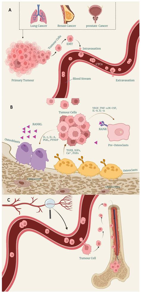 Circulating Tumour Cells in the Prediction of Bone Metastasis