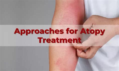 Managing Atopic Diseases across Age Group