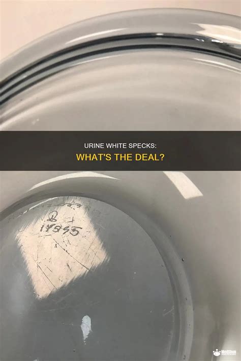 Urine White Specks: What's The Deal? | MedShun