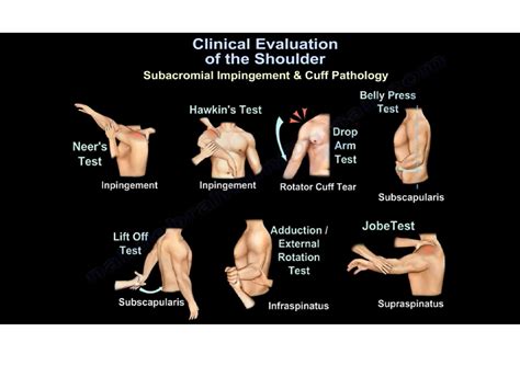 Shoulder Exam Special Tests