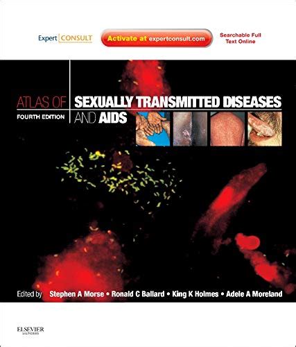 Buy Atlas of Sexually Transmitted Diseases and AIDS: Expert Consult ...