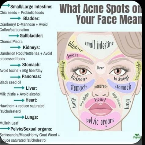 Best 13 A Guide to Face Mapping: What Your Acne Means – Artofit