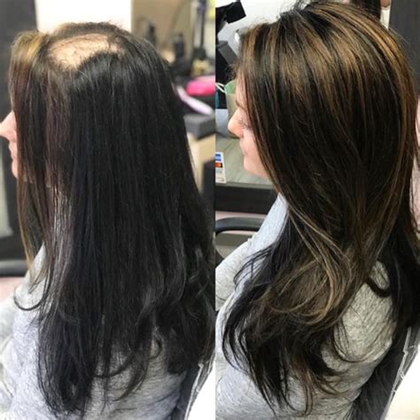 A Guide To Human Hair Toppers