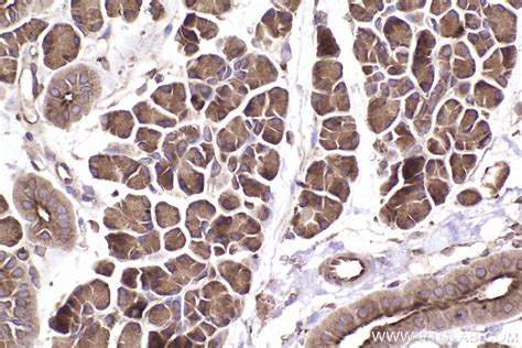 IHCeasy RAB11B Ready-To-Use IHC Kit KHC2501 | Proteintech