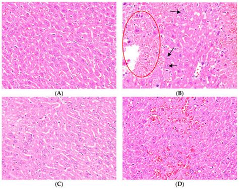 Hepatoprotective Effect of Ugonin M, A Helminthostachys zeylanica ...