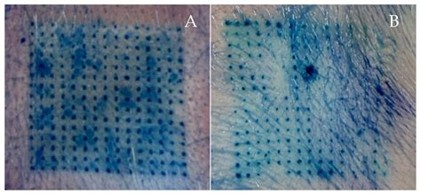 Fabrication and Characterization of Dissolving Microneedles Containing ...