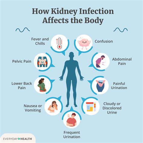 All Kidney Infection Articles