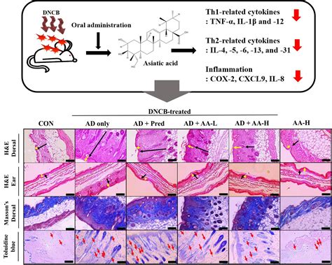 Immunomodulatory and Anti-inflammatory Effects of Asiatic Acid in a ...