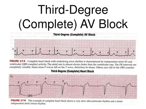 Image result for ACLS Code Blue Algorithm