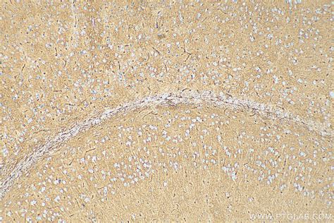 Aquaporin 4 antibody (68448-1-PBS) | Proteintech