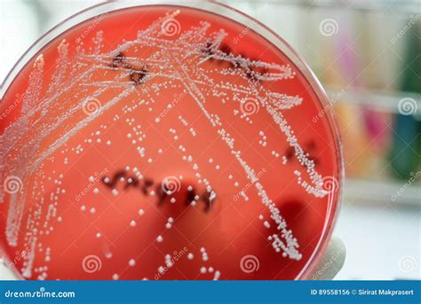 Staphylococcus Speciesm( Staphylococcus Aureus) Stock Photo - Image of ...