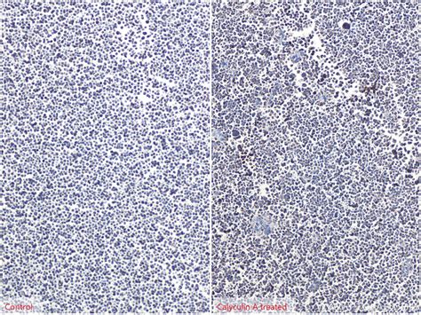 Phospho-EIF4B (Ser406) antibody (80059-1-RR) | Proteintech
