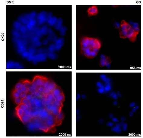 Effects of Scaffolds on Urine- and Urothelial Carcinoma Tissue-Derived ...