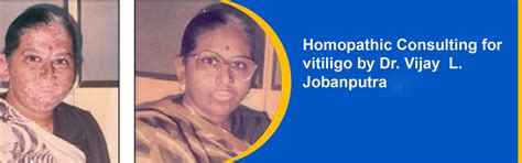 (Call:9870270413)Welcome to Dr. Vijay L. Jobanputra Consulting ...