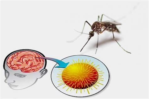 Japanese Encephalitis: Causes, Transmission, Risk Factors, and Symptoms ...