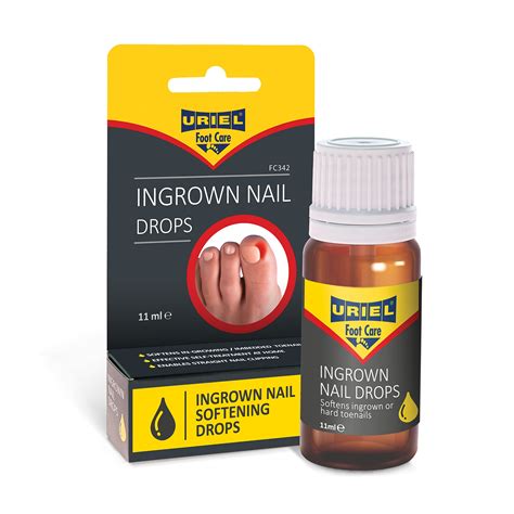 Ingrown Fingernail Treatment