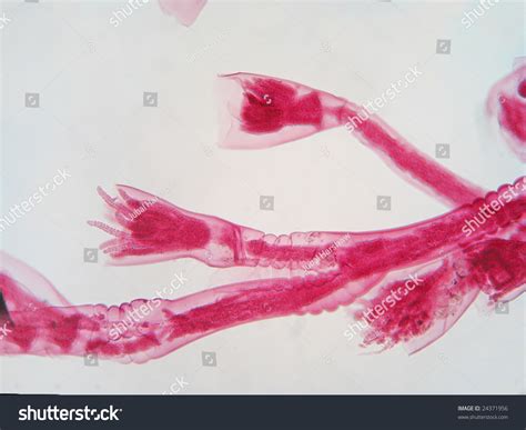 Two Obelia Hydrozoan Polyps Magnification 100 X Stock Photo (Edit Now) 24371956 - Shutterstock