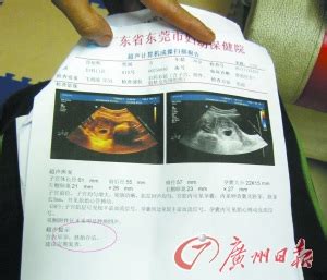 胎儿初检为死胎被建议流产 换医院检查证实存活-搜狐健康