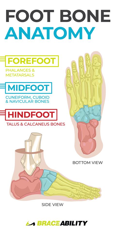 Pain in arch of foot - westbj