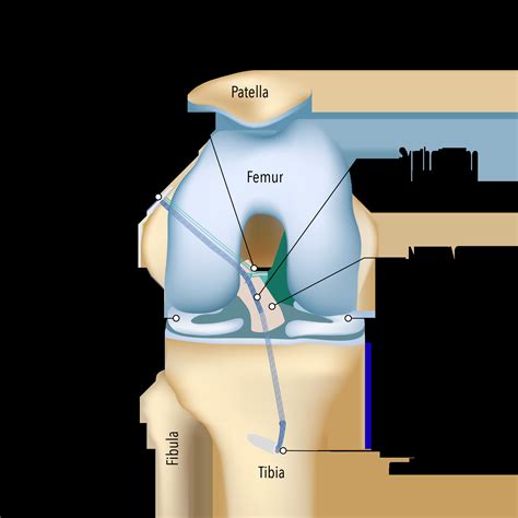 ACL Repair Surgery | ACL Rupture & ACL Tear Repair