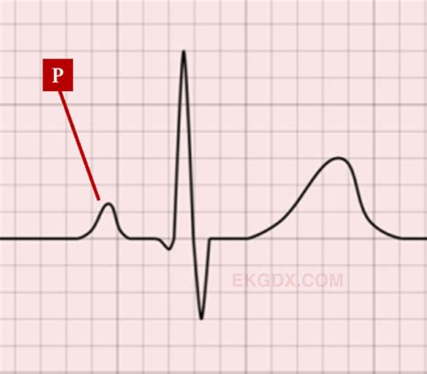 EKGDX - La nueva era del aprendizaje de EKG