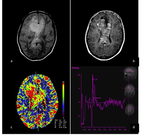 Image result for fMRI Python
