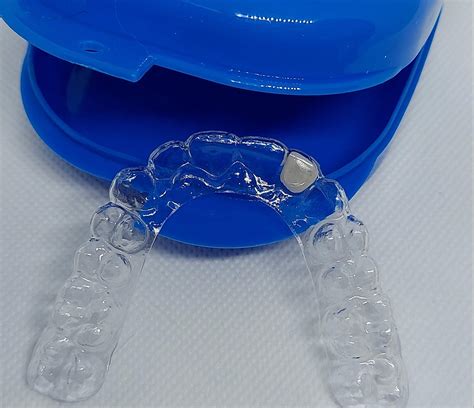 Dental Code For Essix Retainer With Tooth at Thomas Jankowski blog