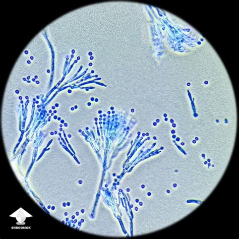 Blue-Green Mold Penicillium Contamination in Mushroom Cultivation