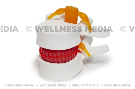 Disk Problem 的图像结果