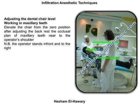 Infiltration Anesthesia Dental Lower 的图像结果