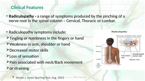 Radiculopathy Vs Neuropathy Vs Myopathy Compilation.pptx