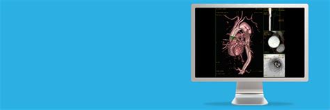 MR VesselIQ Xpress | GE HealthCare (India)