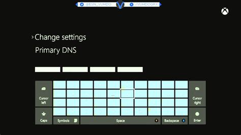 Image result for NAT Type Strict Error Xbox