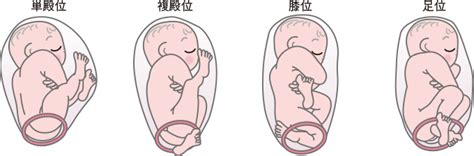 寶寶的胎位有哪些型式？ - BabyHome 新知大耳朵