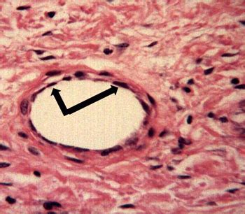 Image result for Ephilehal Tissue Sample