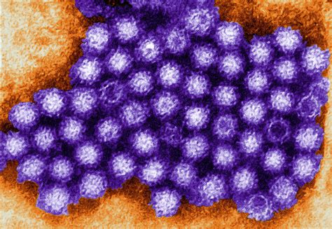 Free picture: noroviruses, belong, genus, norovirus, family, caliciviridae