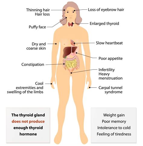 Post-Partum Thyroiditis Explained - Lose Baby Weight - losing weight with hypothyroidism