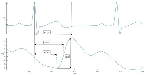 Blood Pressure Prediction Using Ensemble Rules during Isometric ...