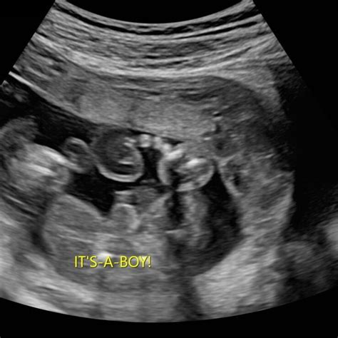 OBGYN Physicians Membership - Specialized Ultrasound CME for Obstetrics ...