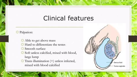 Scrotal swelling | PPTX