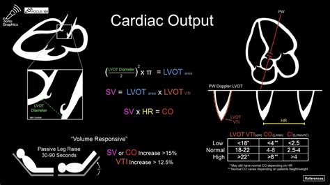 POCUS-Ultrasound Pocket Cards - POCUS 101