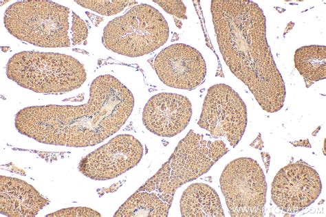 RNF4 antibody (17810-1-AP) | Proteintech