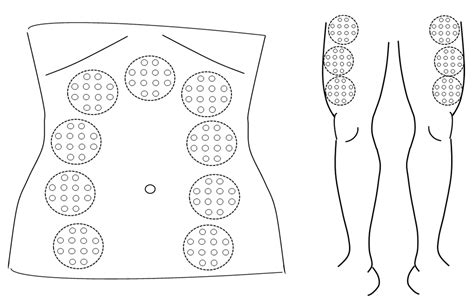 Protocol for a Single-Arm Feasibility Study of Photobiomodulation for ...