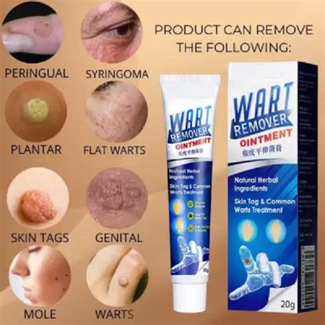 Elecsera Wart Treatment Cream Skin Tag Remover Herbal (100 g)