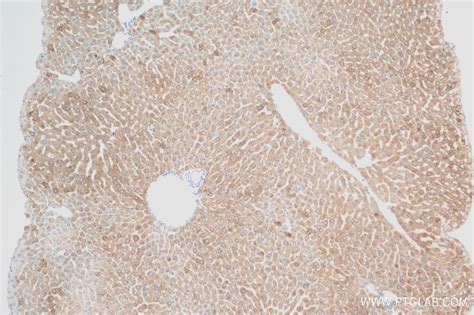 FATP5/SLC27A5 antibody (84557-1-RR) | Proteintech