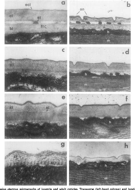 Figure 1 from The Cuticle of Caenorhabditis elegans II. Stage-Specific Changes in Ultrastructure ...