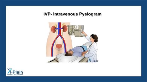 Image result for Normal Intravenous Pyelogram
