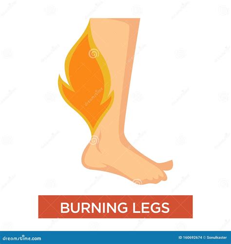 What Does Burning Legs Mean at James Ivery blog