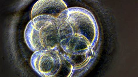 Résultat d’images pour gentechnik 