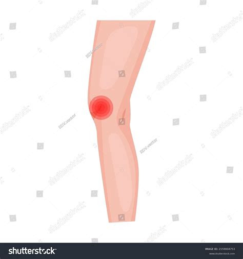 Throbbing Knee Pain Traumas Skin On Stock Vector (Royalty Free) 2159004753 | Shutterstock